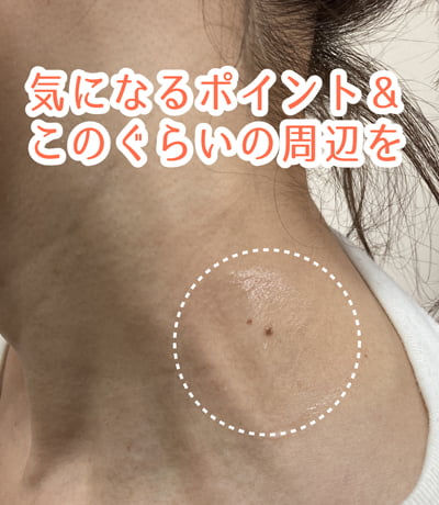 イボクリームIBOリッチエッセンス塗る範囲